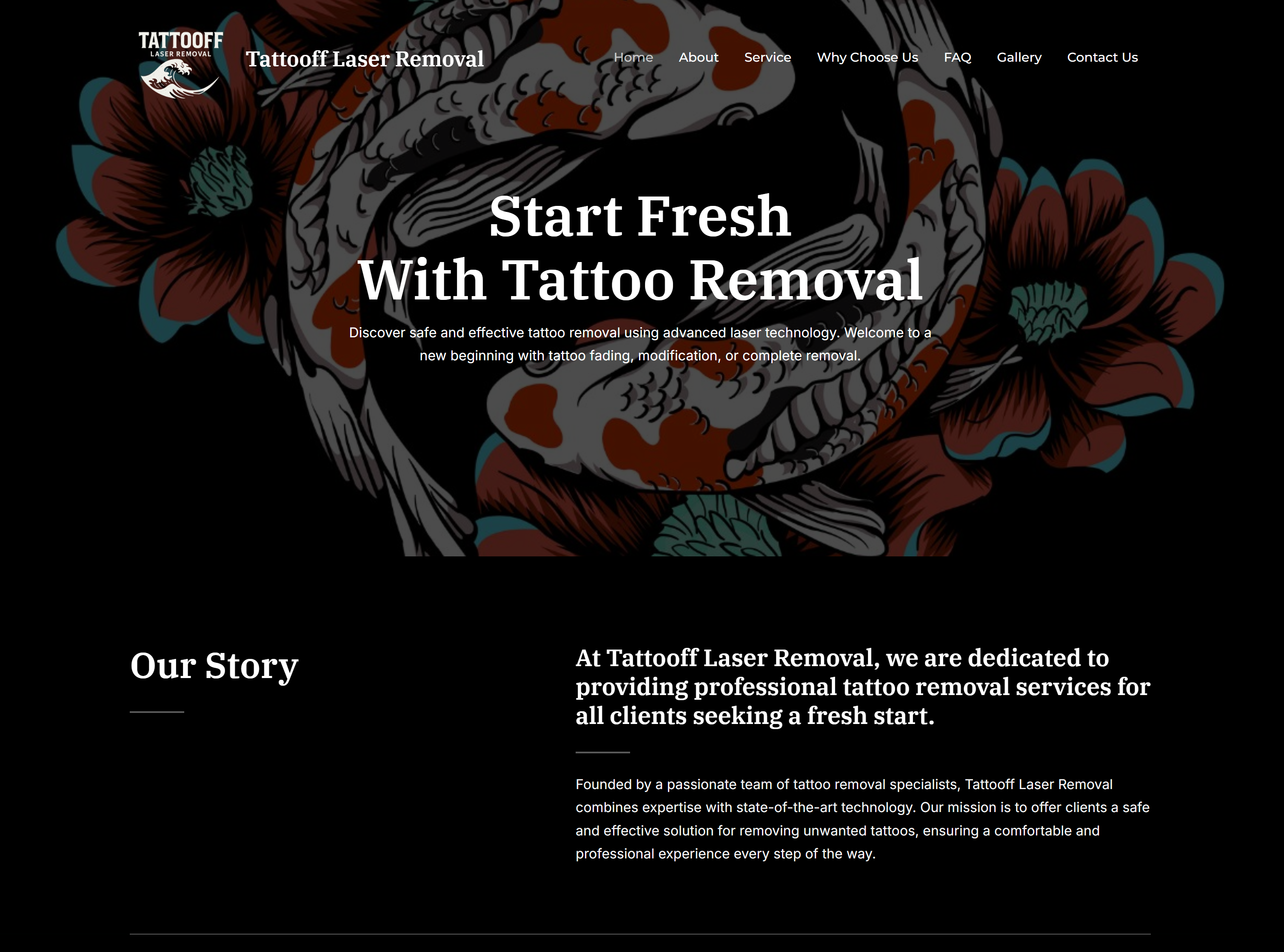 Tattooff Laser Removal